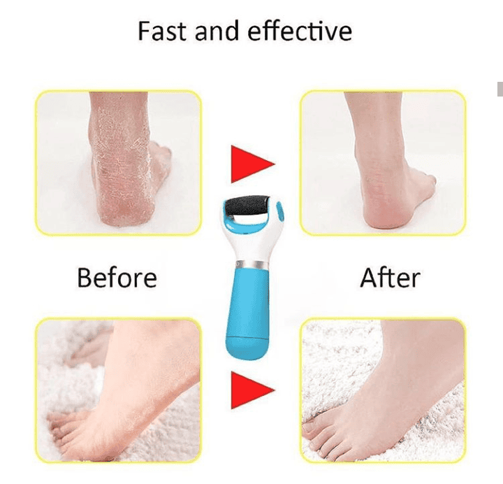 2 In 1 Electric Foot Filer Dry Foot Filer 2 In 1 Electric Foot Filer Dry Foot Filer